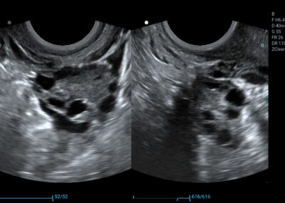 Badanie ginekologiczne