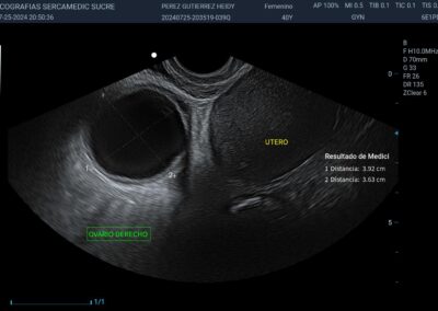 Badanie ginekologiczne