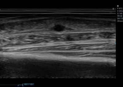 Układu mięśniowo-szkieletowy