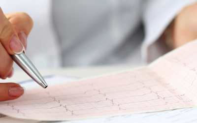 Algorytm Glasgow ECG – dlaczego automatyczna interpretacja EKG to dziś standard, a nie luksus?